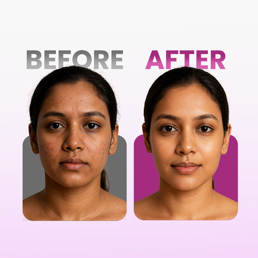 Glamure Kumkumadi Face Serum | Ayurvedic Kumkumadi Tailam Face Oil with Vitamin C, Niacinamide & Hyaluronic Acid | Face Oil for Glowing Skin, Pigmentation & Dark Spots | 30ml
