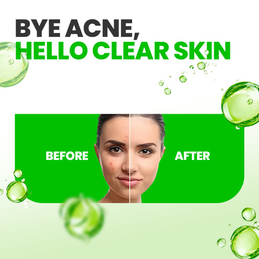 GLAMURE 2% Salicylic Acid Face Serum with 1% Glycolic Acid, Exfoliating Face Serum for Smooth Skin, Pores, Texture & Glow, Men & Women, 30ml