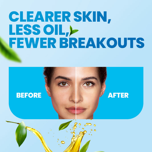 GLAMURE 10% Niacinamide Face Serum with 2% Salicylic Acid n 1% Alpha Arbutin for Dark Spot, Oil Control n Pores, Brightening Serum for Men n Women,30ml