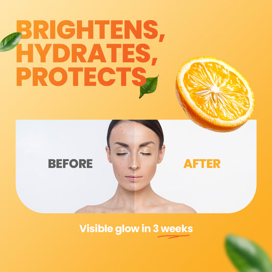 GLAMURE 10% Vitamin C Face Serum with 4% Niacinamide & 1% Hyaluronic Acid | Brightening & Hydrating Serum for Glowing Skin, Dark Spots, and Pigmentation | For Men & Women | 30ml